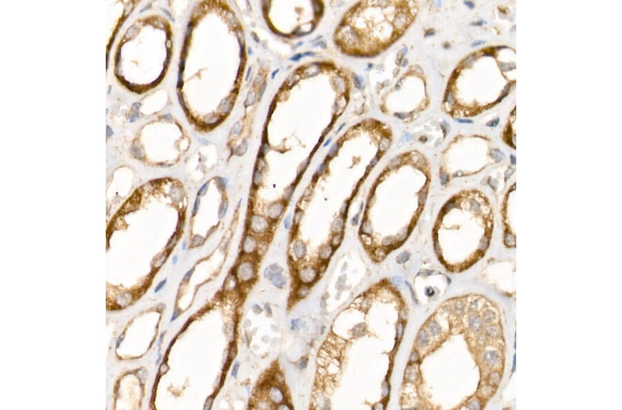 Immunohistochemistry - Anti-AP2B1 Antibody (A13795) - Antibodies.com