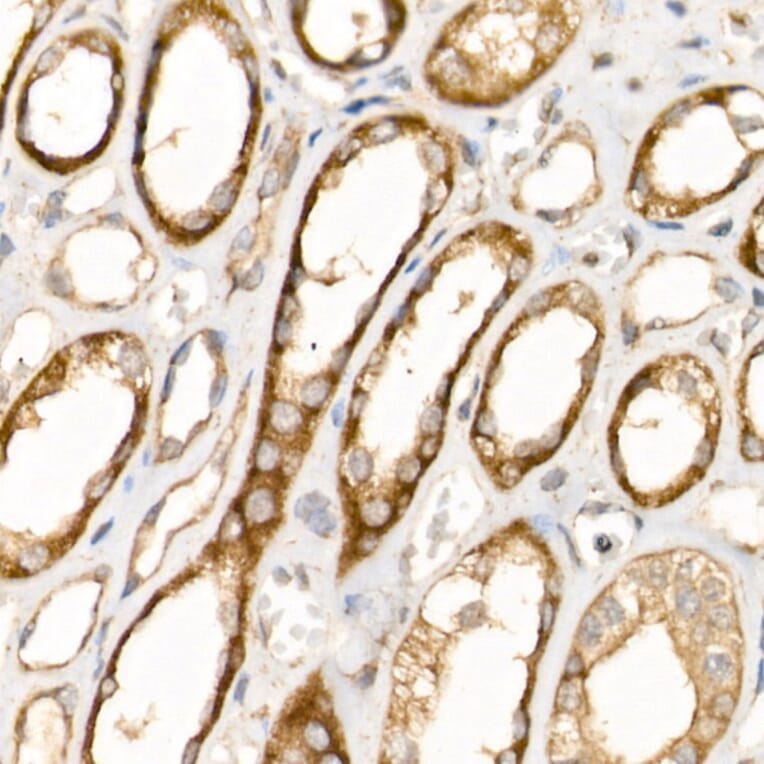Immunohistochemistry - Anti-AP2B1 Antibody (A13795) - Antibodies.com