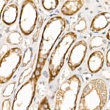 Immunohistochemistry - Anti-AP2B1 Antibody (A13795) - Antibodies.com