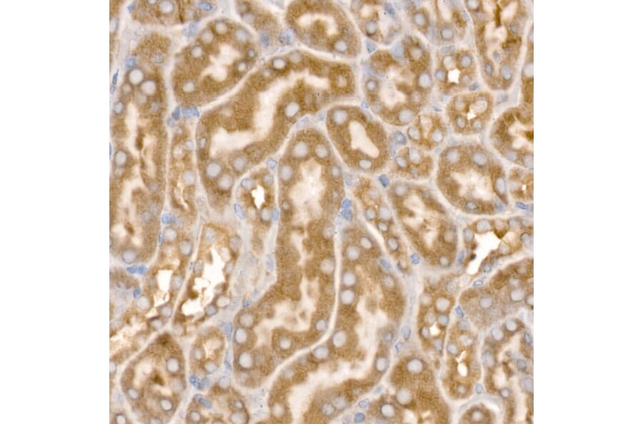 Immunohistochemistry - Anti-AP2B1 Antibody (A13795) - Antibodies.com