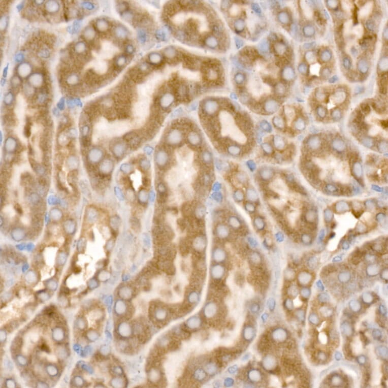 Immunohistochemistry - Anti-AP2B1 Antibody (A13795) - Antibodies.com