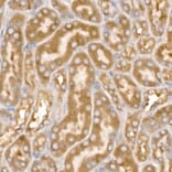 Immunohistochemistry - Anti-AP2B1 Antibody (A13795) - Antibodies.com