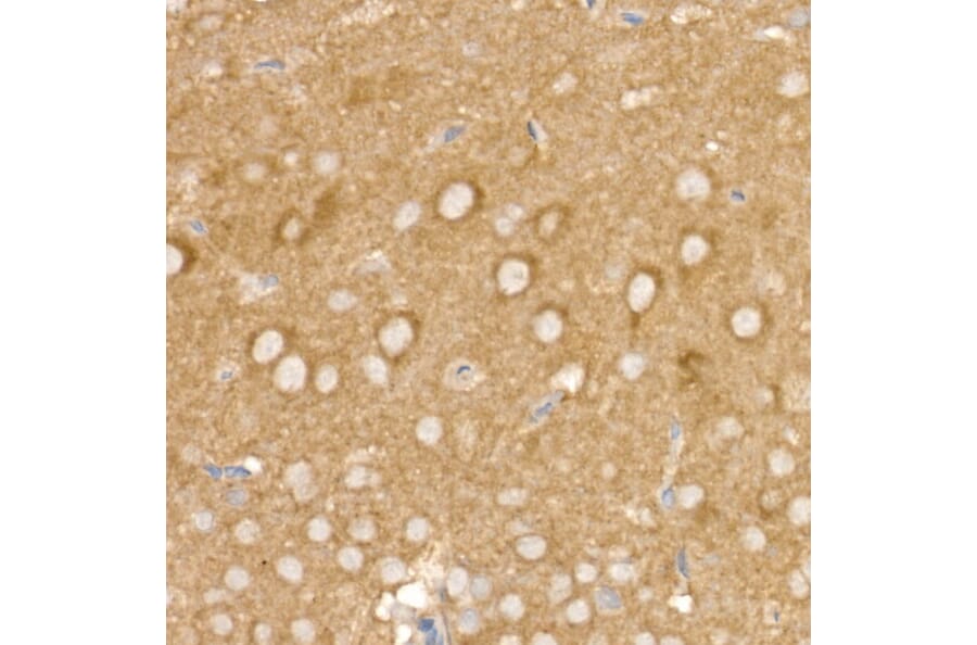 Immunohistochemistry - Anti-AP2B1 Antibody (A13795) - Antibodies.com