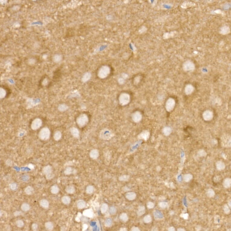 Immunohistochemistry - Anti-AP2B1 Antibody (A13795) - Antibodies.com