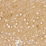 Immunohistochemistry - Anti-AP2B1 Antibody (A13795) - Antibodies.com