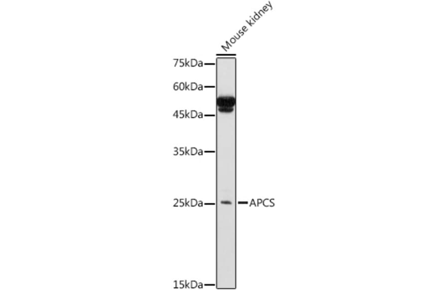 Western Blot - Anti-Serum Amyloid P/SAP Antibody (A13796) - Antibodies.com
