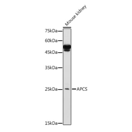Western Blot - Anti-Serum Amyloid P/SAP Antibody (A13796) - Antibodies.com