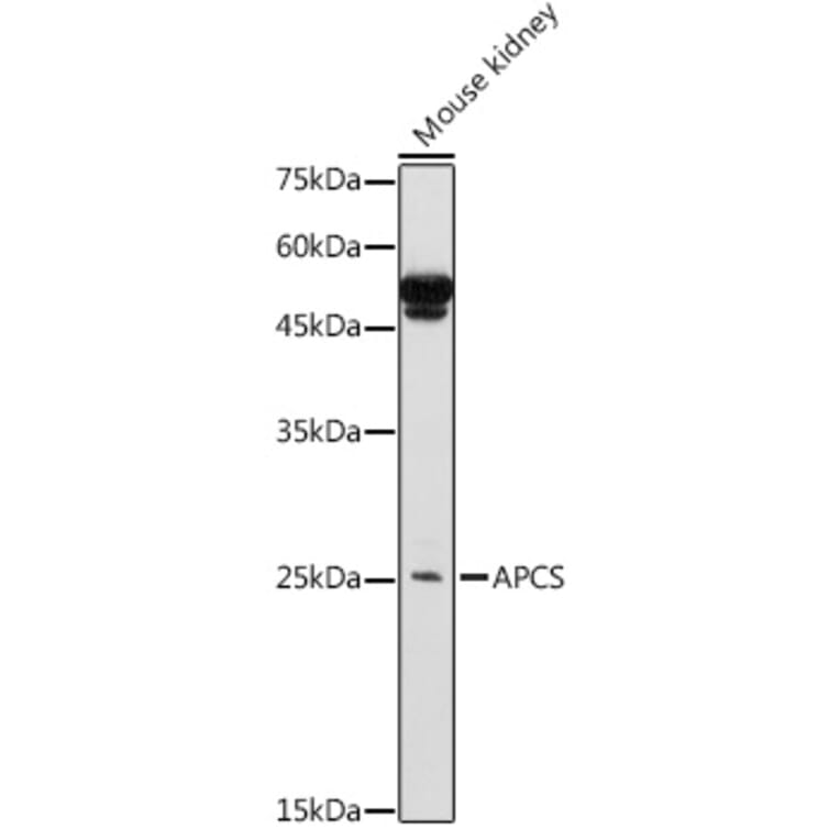 Western Blot - Anti-Serum Amyloid P/SAP Antibody (A13796) - Antibodies.com