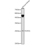Western Blot - Anti-Serum Amyloid P/SAP Antibody (A13796) - Antibodies.com