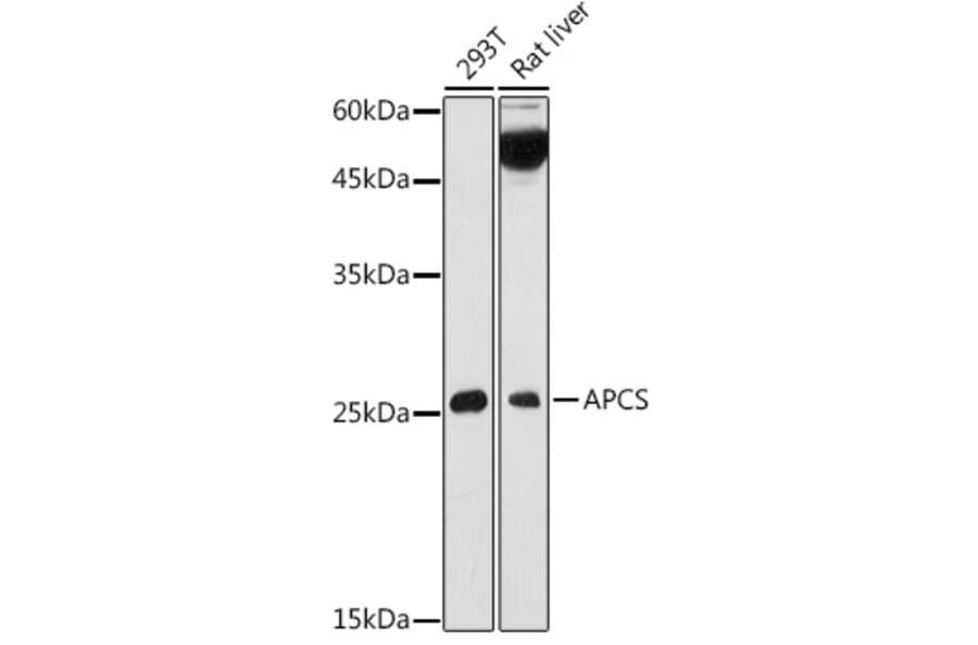 Western Blot - Anti-Serum Amyloid P/SAP Antibody (A13796) - Antibodies.com