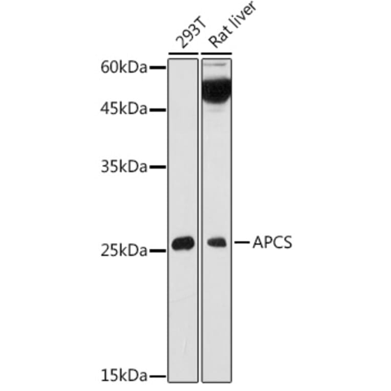Western Blot - Anti-Serum Amyloid P/SAP Antibody (A13796) - Antibodies.com