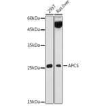 Western Blot - Anti-Serum Amyloid P/SAP Antibody (A13796) - Antibodies.com