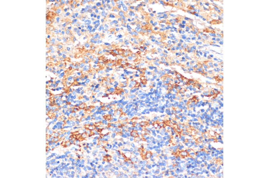 Immunohistochemistry - Anti-Serum Amyloid P/SAP Antibody (A13796) - Antibodies.com