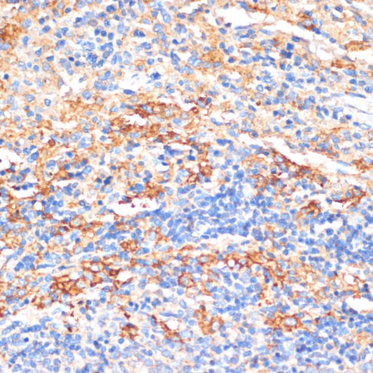 Immunohistochemistry - Anti-Serum Amyloid P/SAP Antibody (A13796) - Antibodies.com