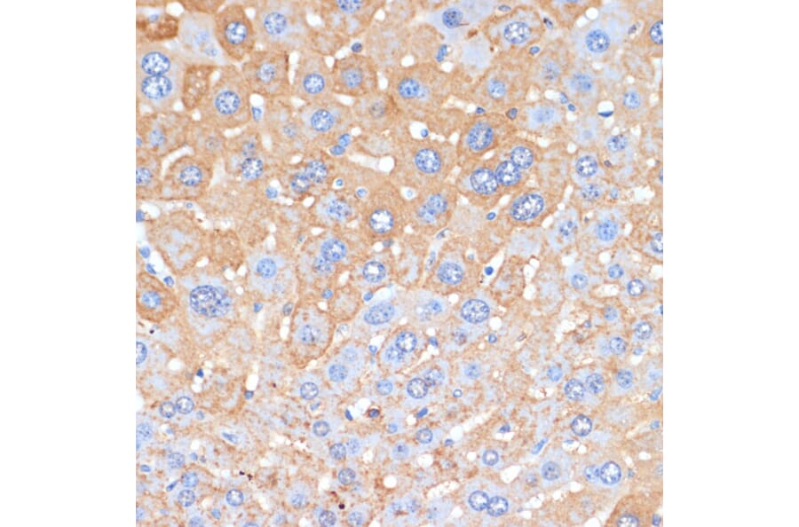 Immunohistochemistry - Anti-Serum Amyloid P/SAP Antibody (A13796) - Antibodies.com