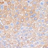 Immunohistochemistry - Anti-Serum Amyloid P/SAP Antibody (A13796) - Antibodies.com