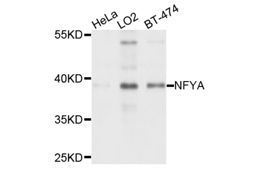 Western Blot - Anti-NFYA Antibody (A1998) - Antibodies.com