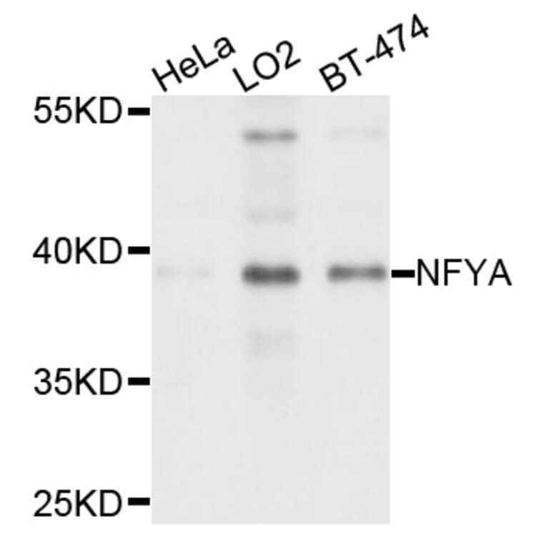 Western Blot - Anti-NFYA Antibody (A1998) - Antibodies.com