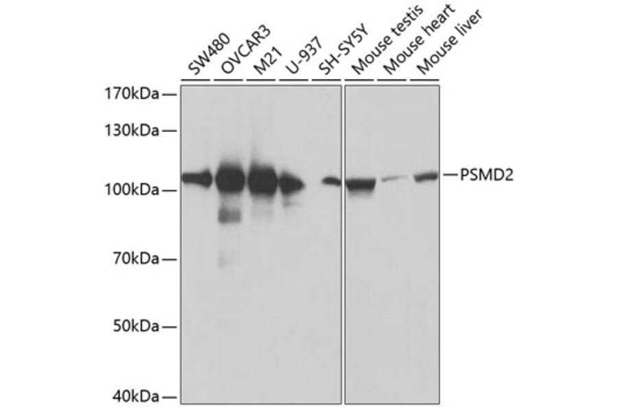 Western Blot - Anti-Proteasome 26S S2/PSMD2 Antibody (A13798) - Antibodies.com