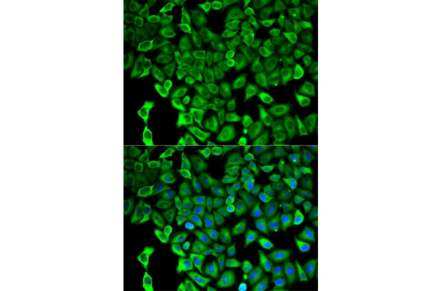 Immunofluorescence - Anti-Proteasome 26S S2/PSMD2 Antibody (A13798) - Antibodies.com