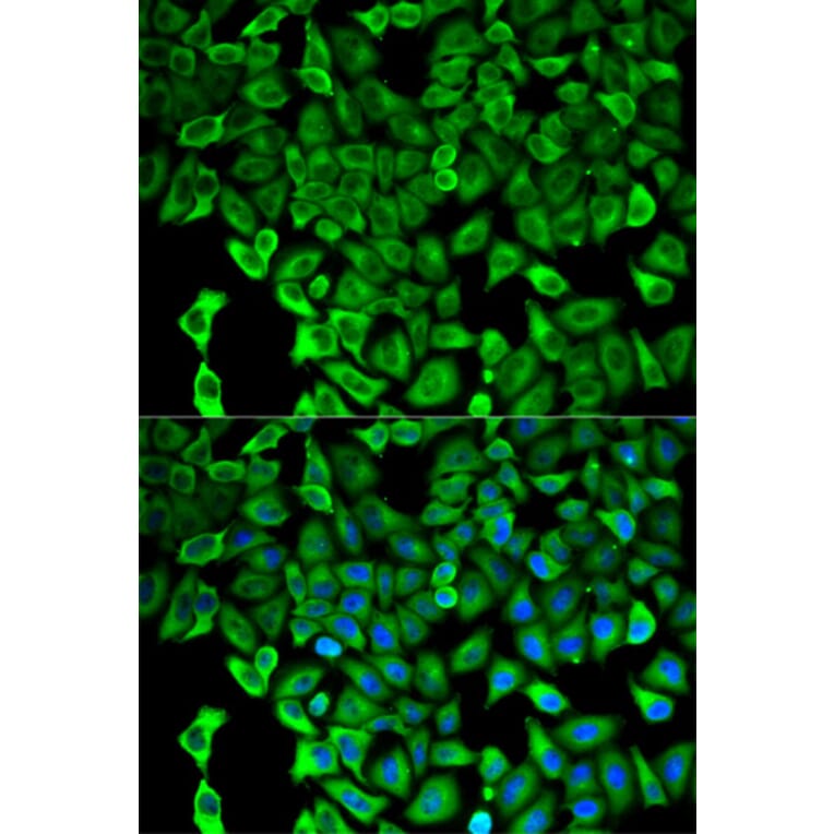 Immunofluorescence - Anti-Proteasome 26S S2/PSMD2 Antibody (A13798) - Antibodies.com