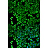 Immunofluorescence - Anti-Proteasome 26S S2/PSMD2 Antibody (A13798) - Antibodies.com