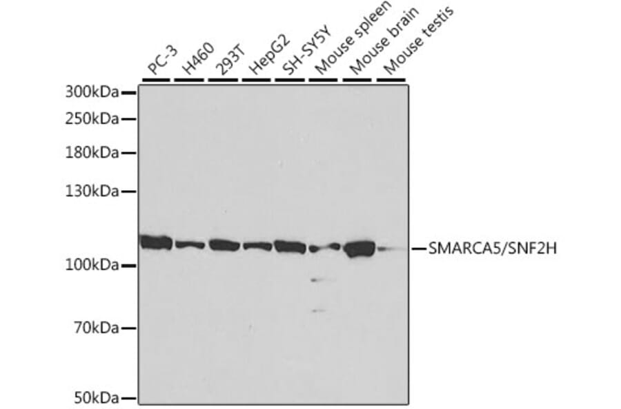 Western Blot - Anti-SNF2H Antibody (A13799) - Antibodies.com