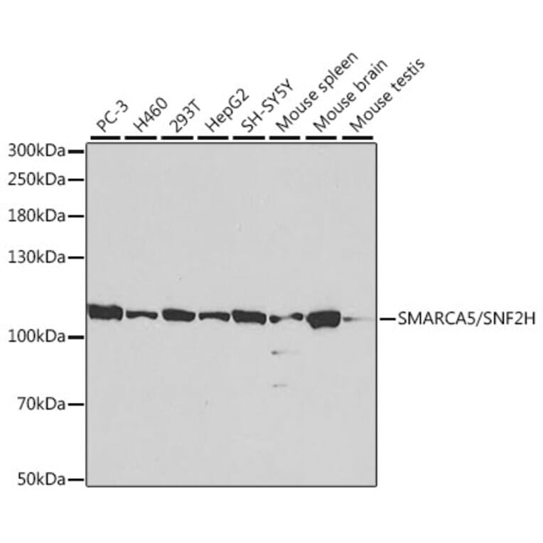 Western Blot - Anti-SNF2H Antibody (A13799) - Antibodies.com