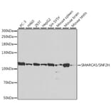 Western Blot - Anti-SNF2H Antibody (A13799) - Antibodies.com