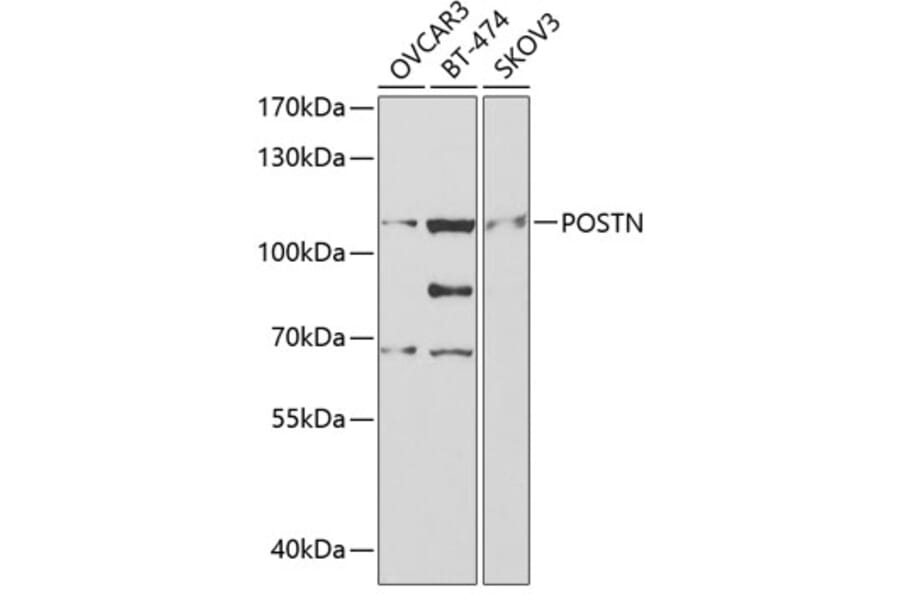Western Blot - Anti-POSTN Antibody (A2003) - Antibodies.com