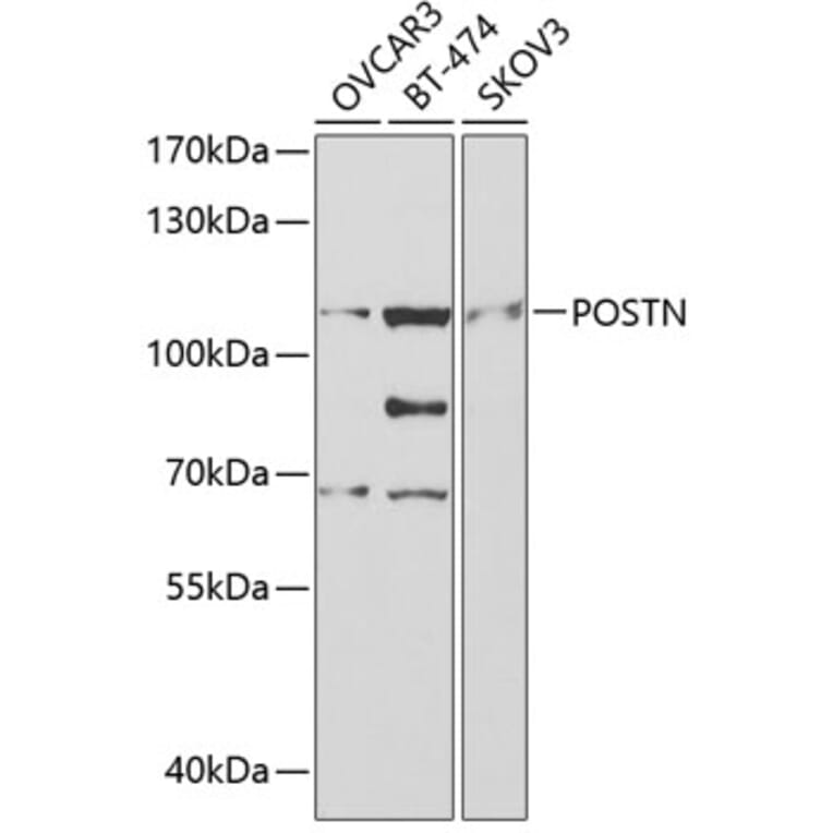 Western Blot - Anti-POSTN Antibody (A2003) - Antibodies.com