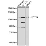 Western Blot - Anti-POSTN Antibody (A2003) - Antibodies.com