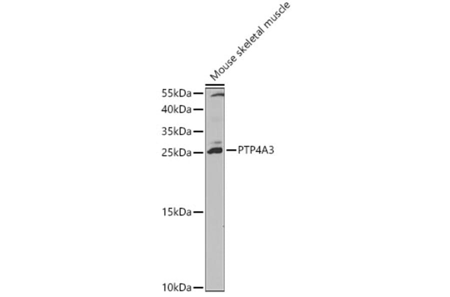 Western Blot - Anti-PTP4A3/PRL-R Antibody (A13803) - Antibodies.com