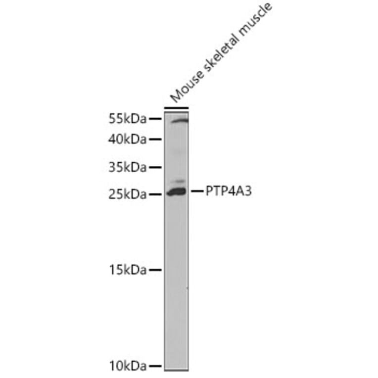 Western Blot - Anti-PTP4A3/PRL-R Antibody (A13803) - Antibodies.com
