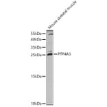 Western Blot - Anti-PTP4A3/PRL-R Antibody (A13803) - Antibodies.com