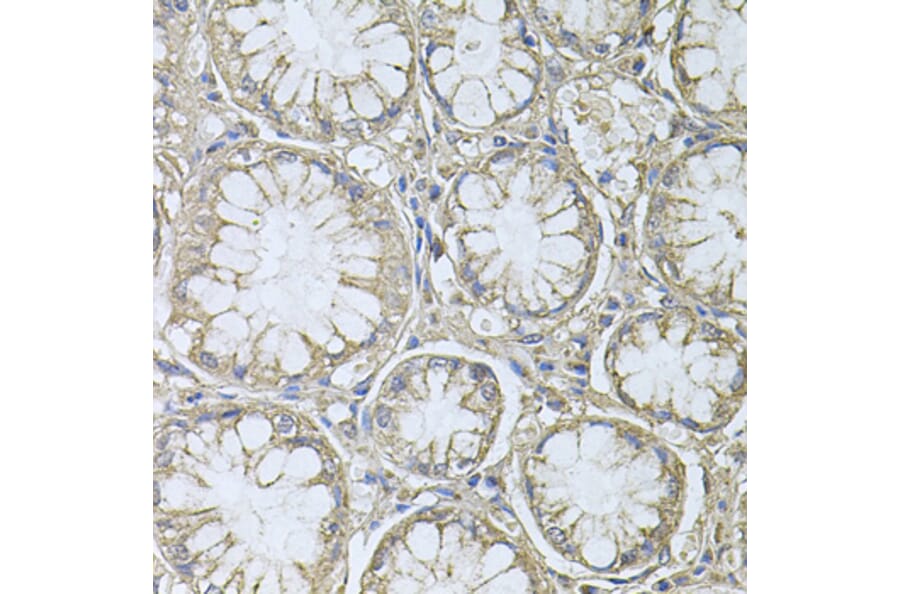 Immunohistochemistry - Anti-PTP4A3/PRL-R Antibody (A13803) - Antibodies.com