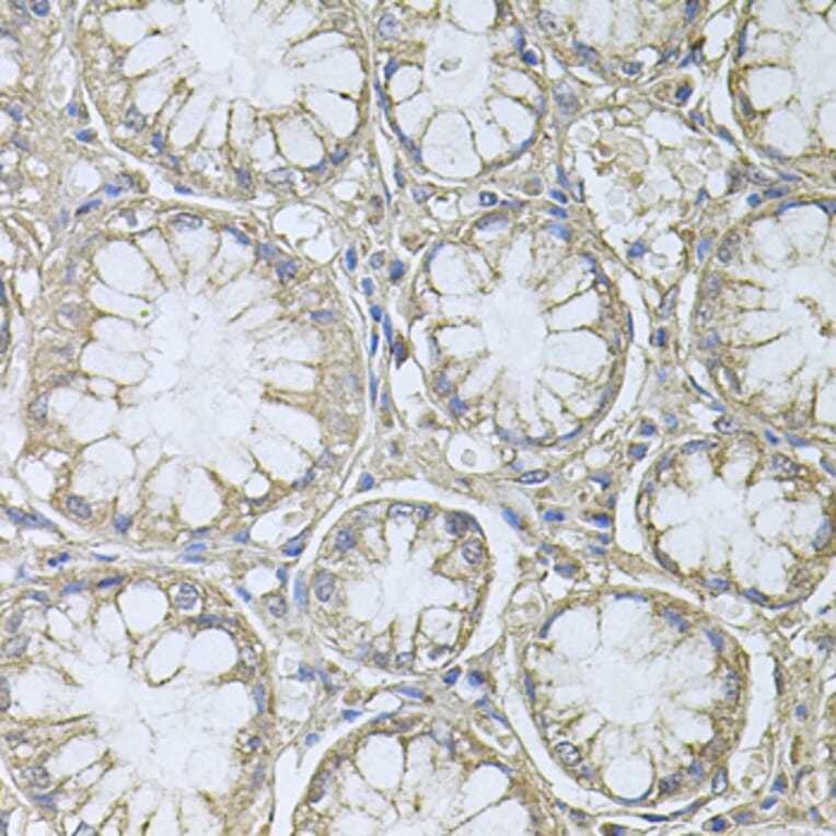 Immunohistochemistry - Anti-PTP4A3/PRL-R Antibody (A13803) - Antibodies.com