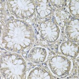 Immunohistochemistry - Anti-PTP4A3/PRL-R Antibody (A13803) - Antibodies.com