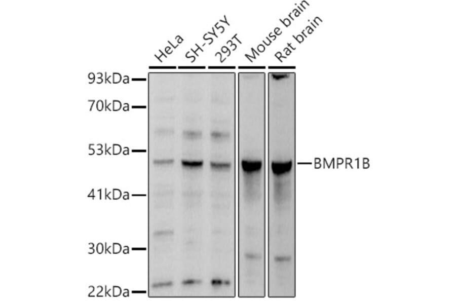 Western Blot - Anti-BMPR1B Antibody (A13804) - Antibodies.com
