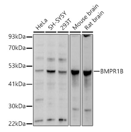 Western Blot - Anti-BMPR1B Antibody (A13804) - Antibodies.com
