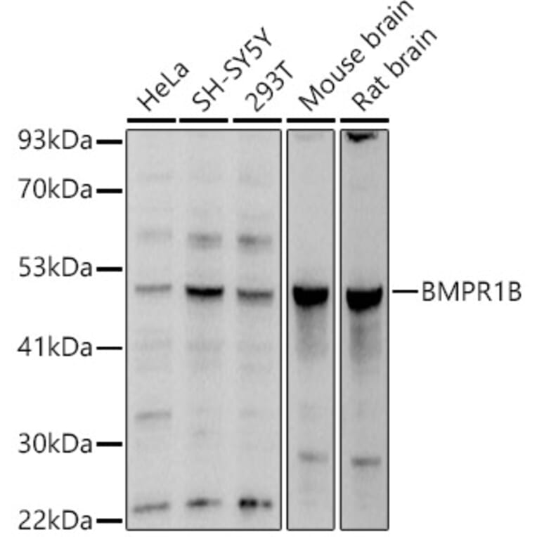 Western Blot - Anti-BMPR1B Antibody (A13804) - Antibodies.com