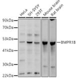 Western Blot - Anti-BMPR1B Antibody (A13804) - Antibodies.com