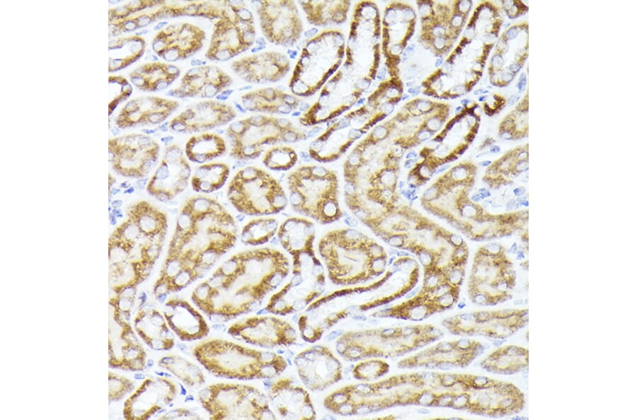 Immunohistochemistry - Anti-BMPR1B Antibody (A13804) - Antibodies.com