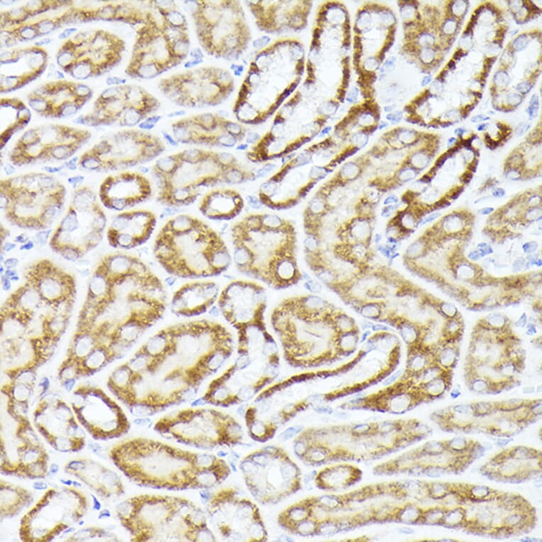 Immunohistochemistry - Anti-BMPR1B Antibody (A13804) - Antibodies.com