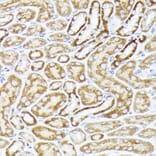 Immunohistochemistry - Anti-BMPR1B Antibody (A13804) - Antibodies.com