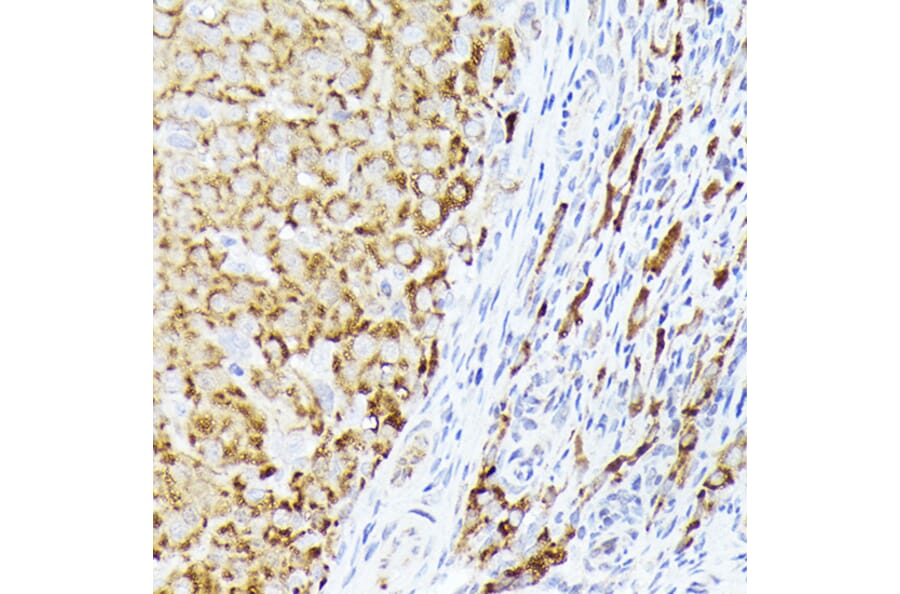 Immunohistochemistry - Anti-BMPR1B Antibody (A13804) - Antibodies.com