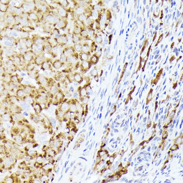 Immunohistochemistry - Anti-BMPR1B Antibody (A13804) - Antibodies.com