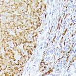 Immunohistochemistry - Anti-BMPR1B Antibody (A13804) - Antibodies.com