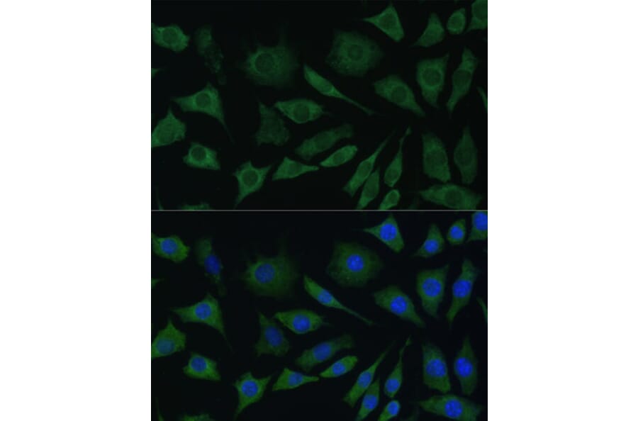 Immunofluorescence - Anti-BMPR1B Antibody (A13804) - Antibodies.com