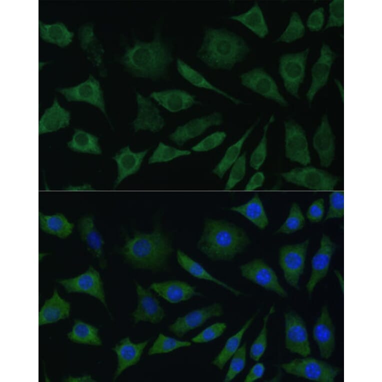 Immunofluorescence - Anti-BMPR1B Antibody (A13804) - Antibodies.com